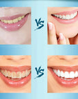 Teeth Whitening Powder